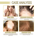 Succession Hair Aceite esencial Para el cabello dañado Nutritivo Alisado Aceite de Romero Crecimiento del cabello