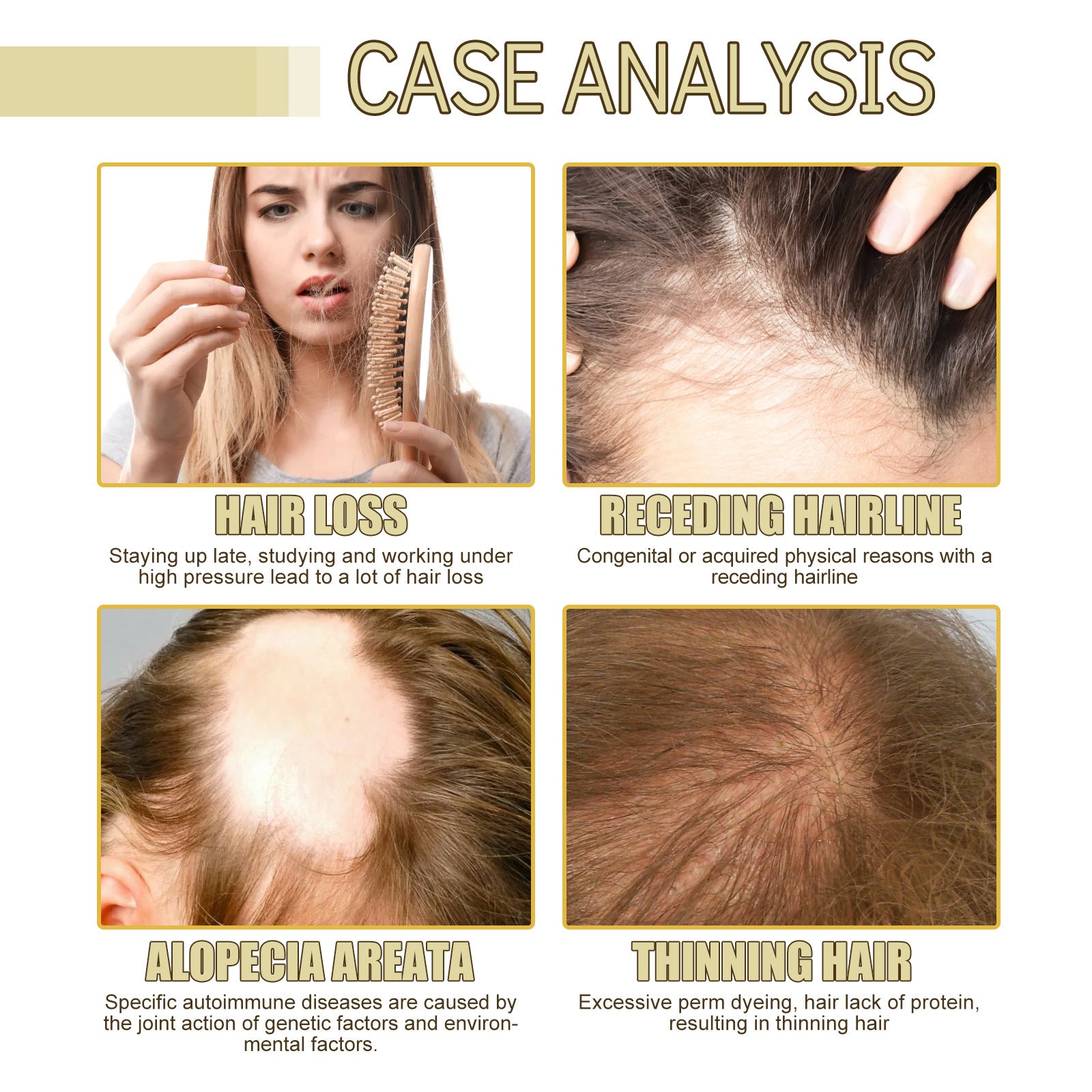 Succession Hair Aceite esencial Para el cabello dañado Nutritivo Alisado Aceite de Romero Crecimiento del cabello