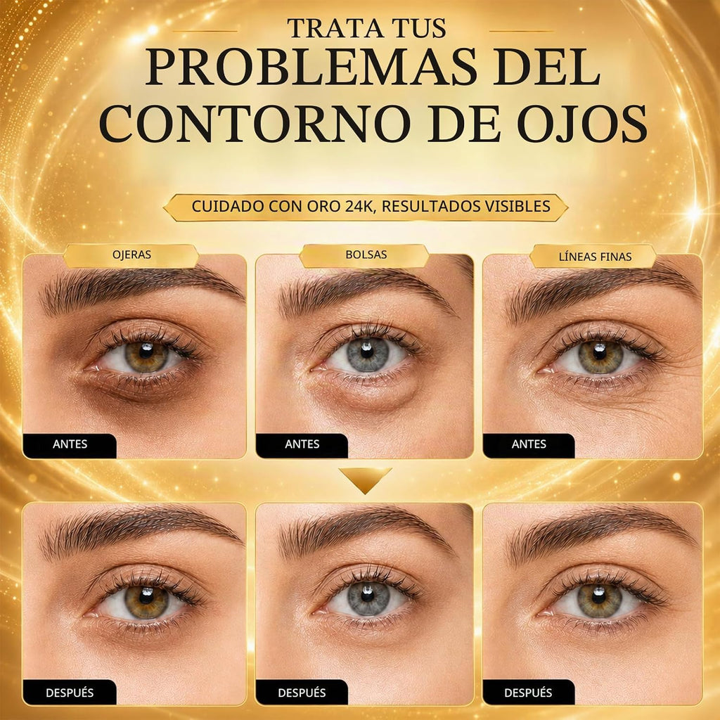 EELHOE 24K Gold Eye Patches – Anti‑Aging, Dark Circle & Puffiness Relief (60 pcs)